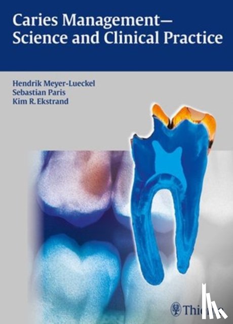  - Caries Management - Science and Clinical Practice