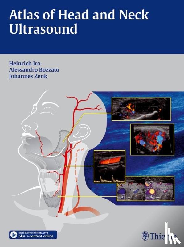 Iro, Heinrich, Bozzato, Alessandro, Zenk, Johannes - Atlas of Head and Neck Ultrasound