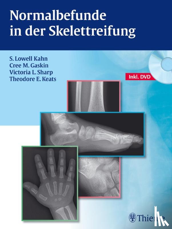 Kahn, S. Lowell, Gaskin, Cree M., Sharp, Victoria L., Keats, Theodore E. - Normalbefunde in der Skelettreifung