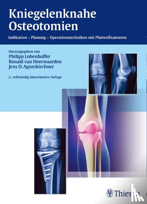  - Kniegelenknahe Osteotomien