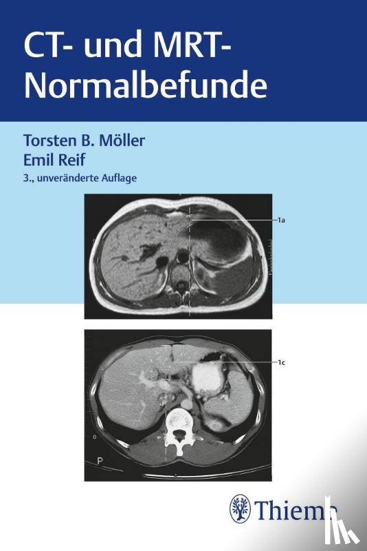 Möller, Torsten Bert, Reif, Emil - CT und MRT Normalbefunde