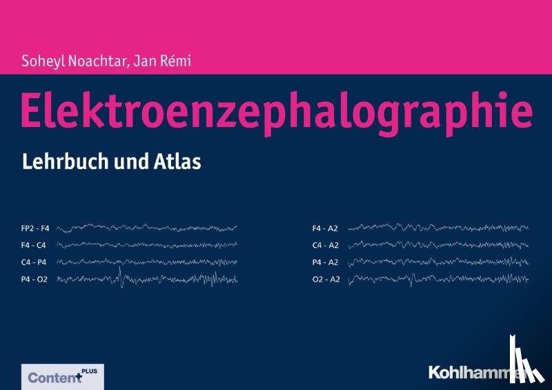 Noachtar, Soheyl, Rémi, Jan - Elektroenzephalographie