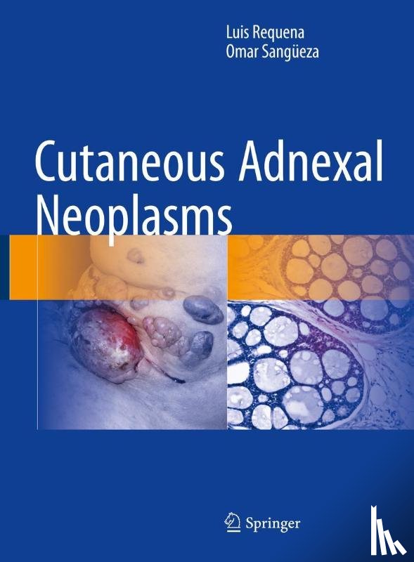 Requena, Luis, Sangueza, Omar - Cutaneous Adnexal Neoplasms