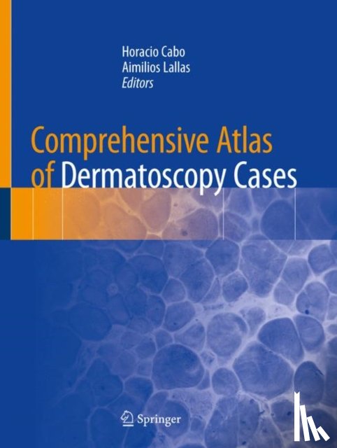  - Comprehensive Atlas of Dermatoscopy Cases