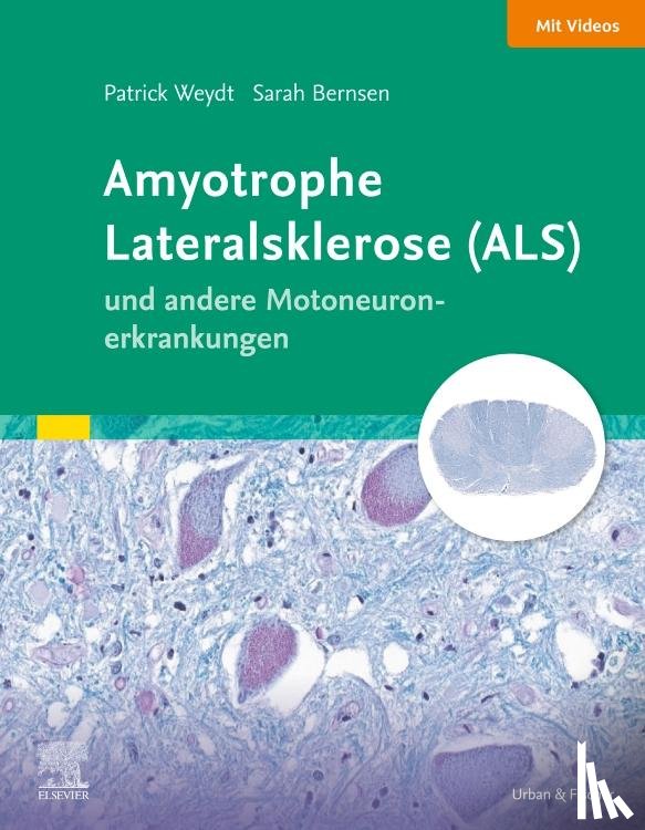 Bernsen, Sarah, Friese, Johannes, Körtvelyessy, Peter, Weydt, Patrick - Amyotrophe Lateralsklerose (ALS) und andere Motoneuronerkrankungen