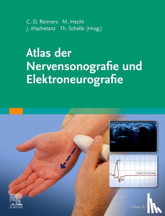  - Atlas der Nervensonografie und Elektroneurografie