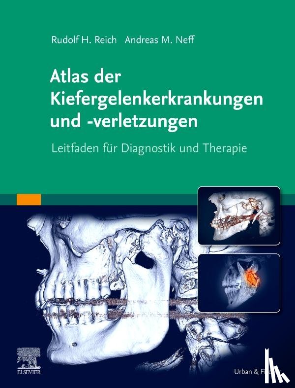 Neff, Andreas - Atlas der Kiefergelenkerkrankungen und -verletzungen
