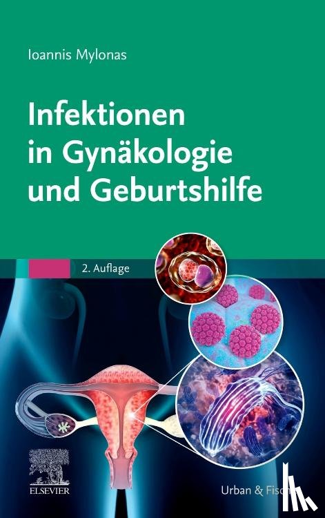 Mylonas, Ioannis - Infektionen in Gynäkologie und Geburtshilfe