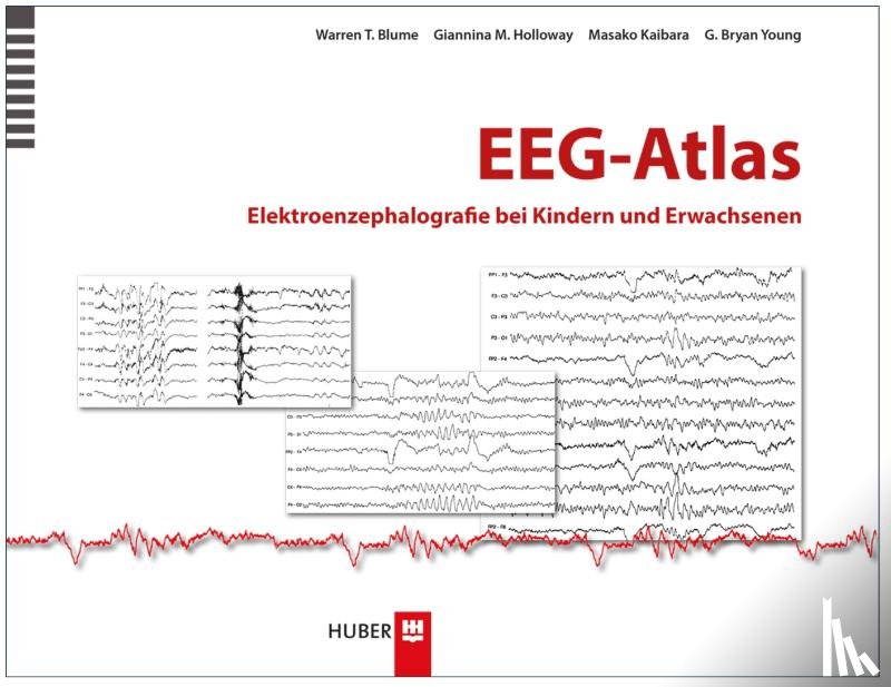 Blume, Warren T., Holloway, Giannina M., Kaibara, Masako, Young, G. Bryan - EEG-Atlas