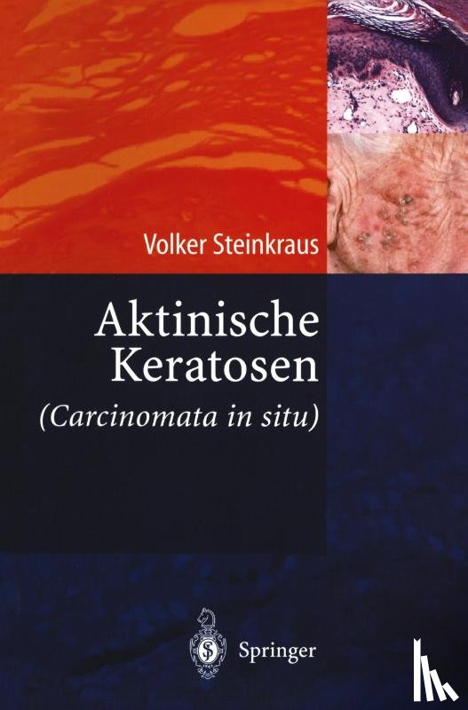 Volker Steinkraus - Aktinische Keratosen (Carcinomata in Situ)