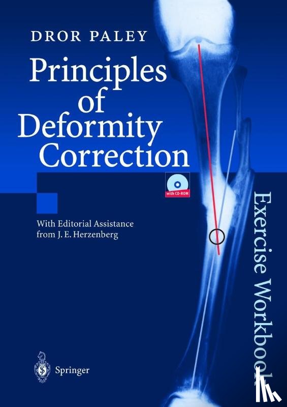 Paley, Dror - Principles of Deformity Correction
