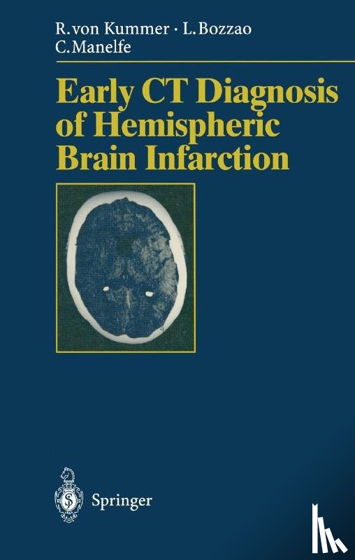 Rudiger v. Kummer, Luigi Bozzao, Claude Manelfe - Early CT Diagnosis of Hemispheric Brain Infarction