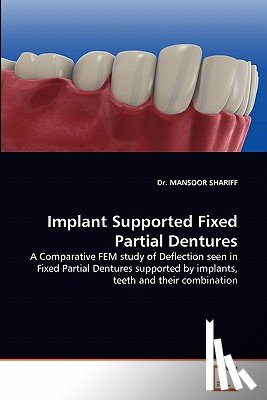 Shariff, Dr Mansoor - Implant Supported Fixed Partial Dentures