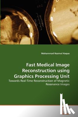 Haque, Mohammad Nazmul - Fast Medical Image Reconstruction using Graphics Processing Unit