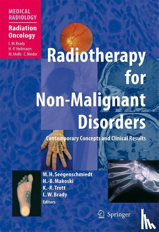 Michael Heinrich Seegenschmiedt, Hans-Bruno Makoski, Klaus-Rudiger Trott, Luther W. Brady - Radiotherapy for Non-Malignant Disorders