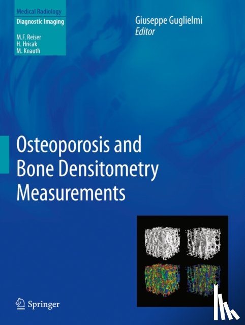  - Osteoporosis and Bone Densitometry Measurements