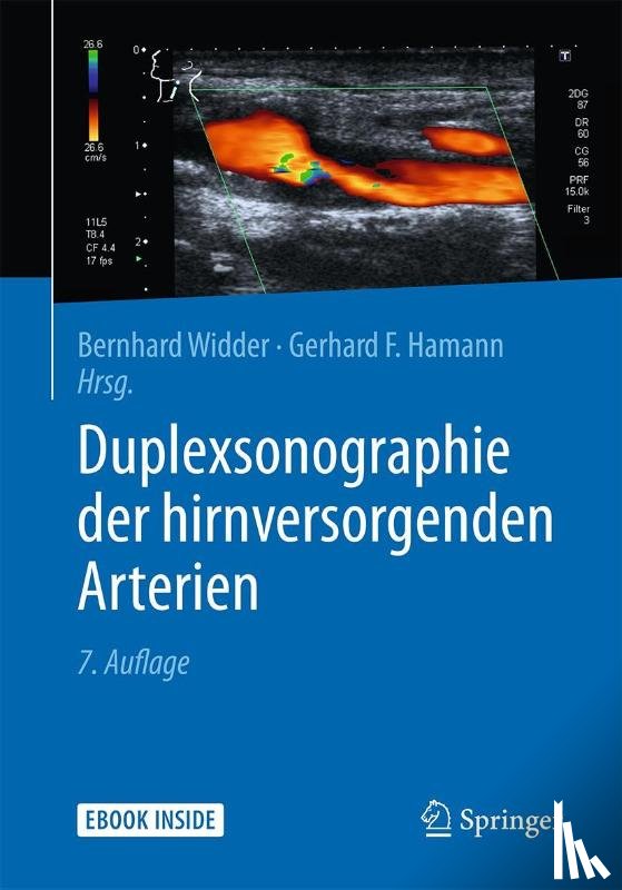  - Duplexsonographie der hirnversorgenden Arterien