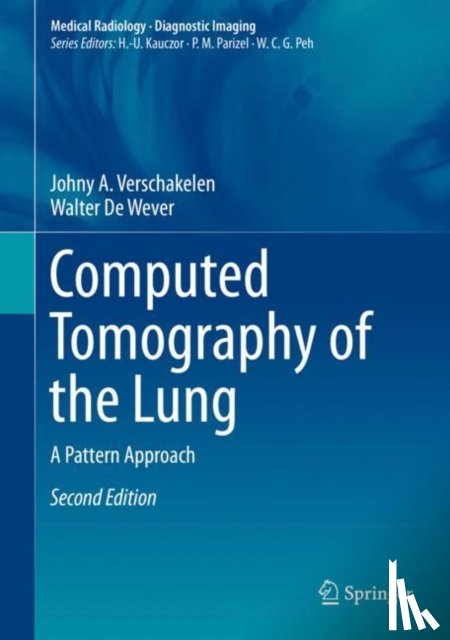 Verschakelen, Johny A., De Wever, Walter - Computed Tomography of the Lung