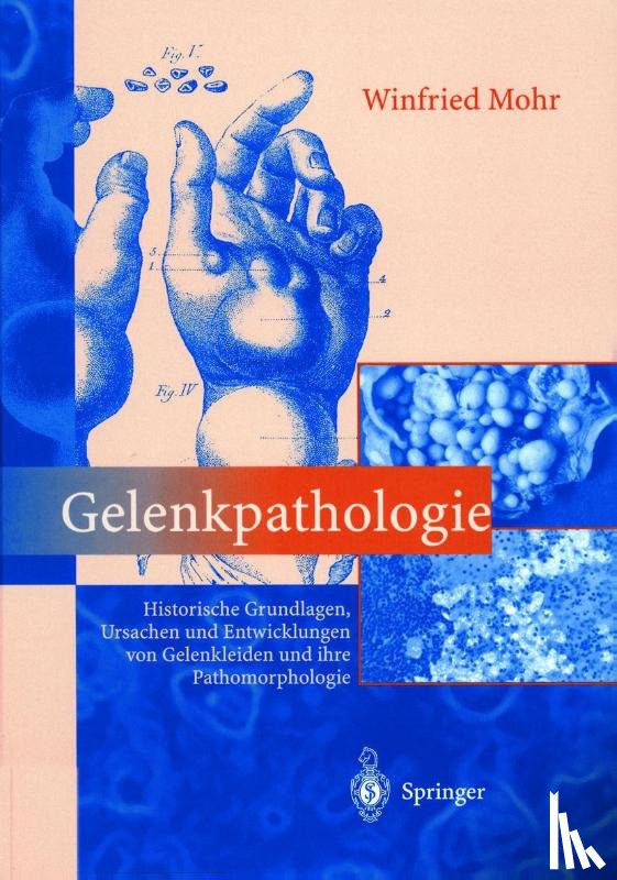 Mohr, Winfried - Gelenkpathologie