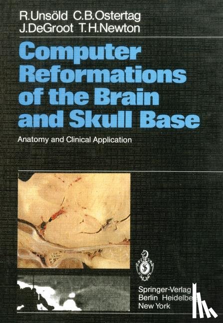 Unsold, R., Ostertag, C. B., DeGroot, J., Newton, T. H. - Computer Reformations of the Brain and Skull Base