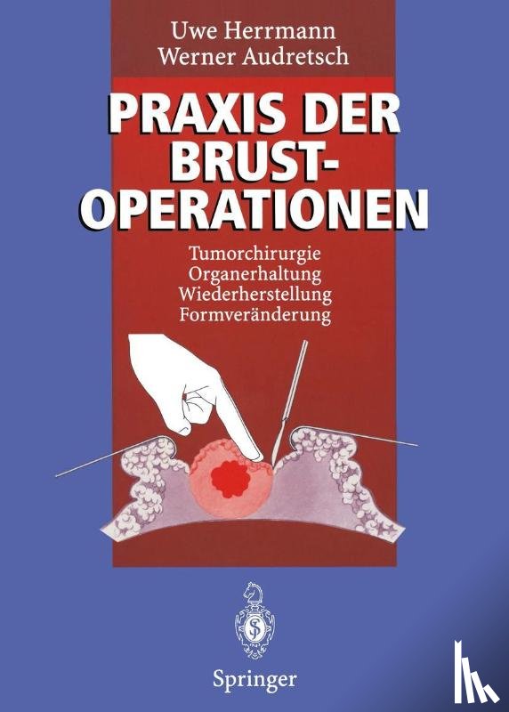 Uwe Herrmann, Werner Audretsch - Praxis Der Brustoperationen