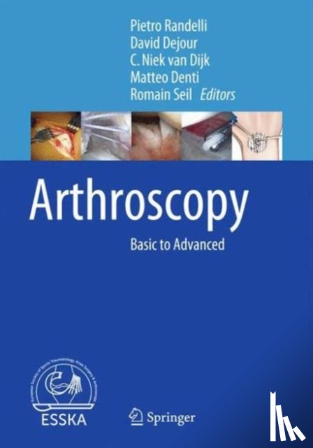 Pietro Randelli, David Dejour, C. Niek van Dijk, Matteo Denti - Arthroscopy