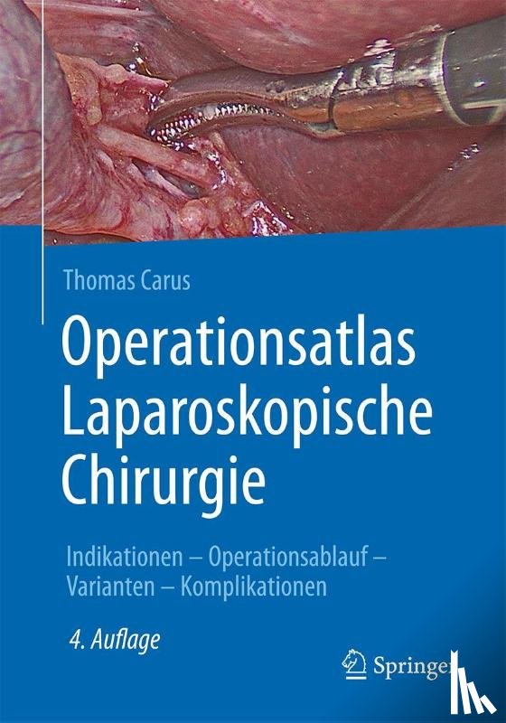 Carus, Thomas - Operationsatlas Laparoskopische Chirurgie
