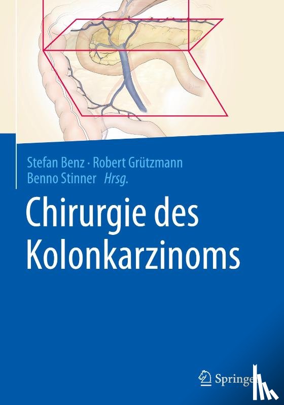  - Chirurgie des Kolonkarzinoms