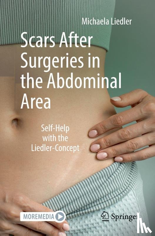 Liedler, Michaela - Scars After Surgeries in the Abdominal Area