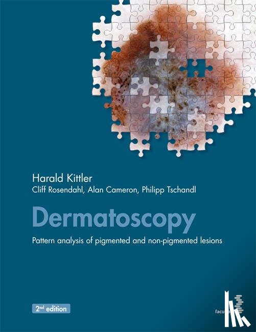 Kittler, Harald, Rosendahl, Cliff, Cameron, Alan, Tschandl, Philipp - Dermatoscopy