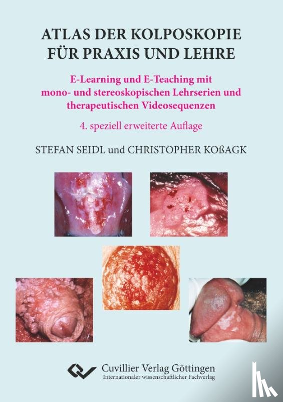 Koßagk, Christopher, Seidl, Stefan - Atlas der Kolposkopie für Praxis und Lehre. E-Learning und E-Teaching mit mono- und stereoskopischen Lehrserien und therapeutischen Videosequenzen