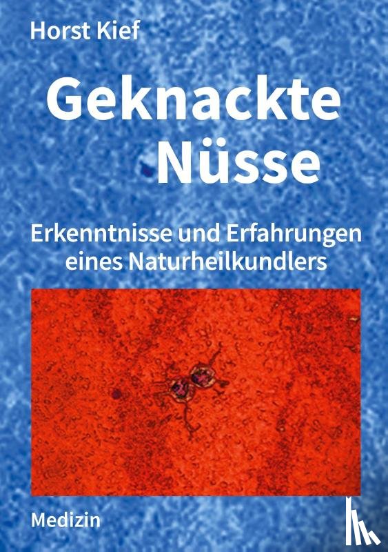 Kief, Horst - Geknackte Nusse