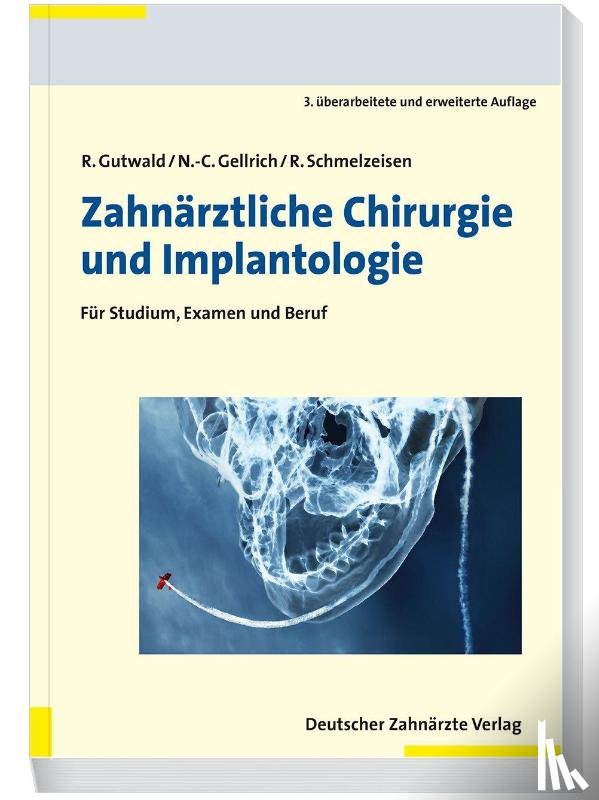 Gutwald, Ralf, Gellrich, N. -C., Schmelzeisen, Rainer - Zahnärztliche Chirurgie und Implantologie