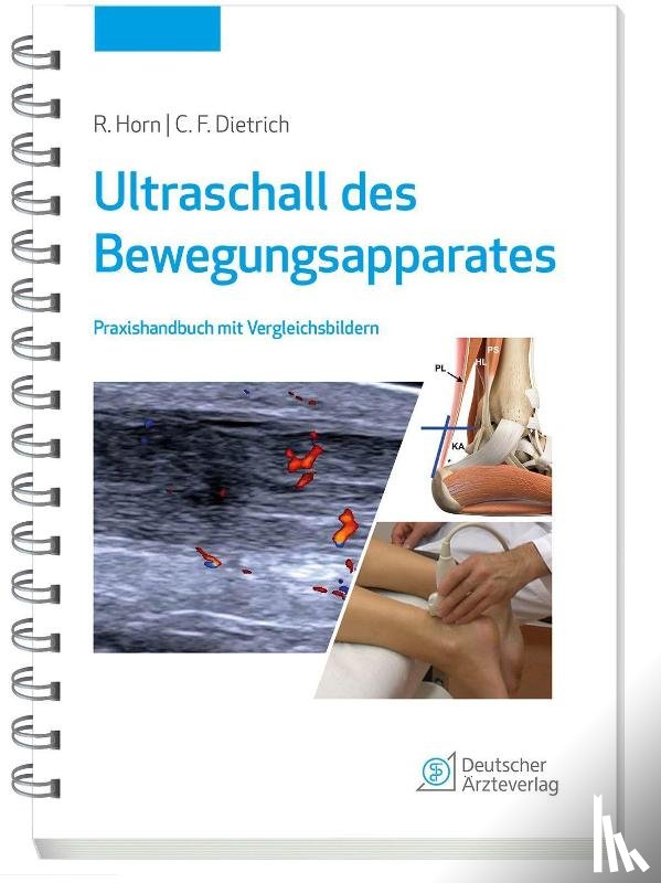 Horn, Rudolf, Dietrich, Christoph F. - Ultraschall des Bewegungsapparates