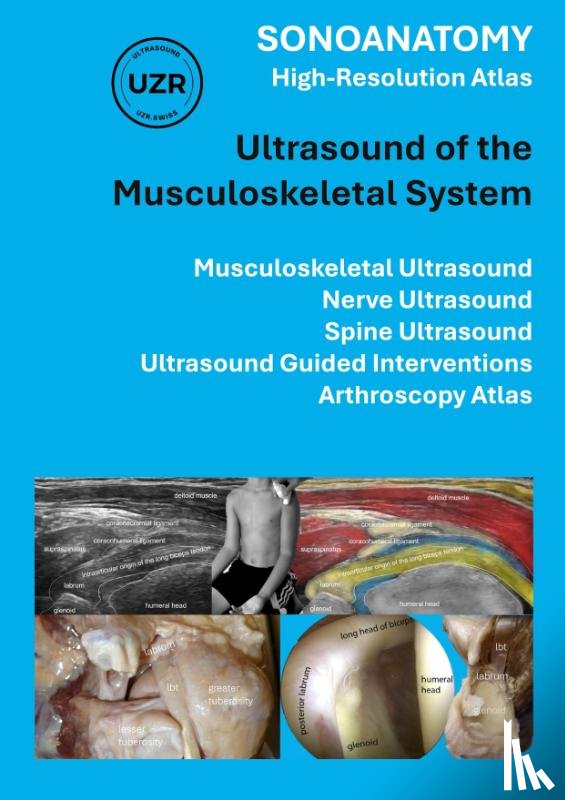Tamborrini, Giorgio - Sonoanatomy - High-Resolution Atlas - Ultrasound of the Musculoskeletal System