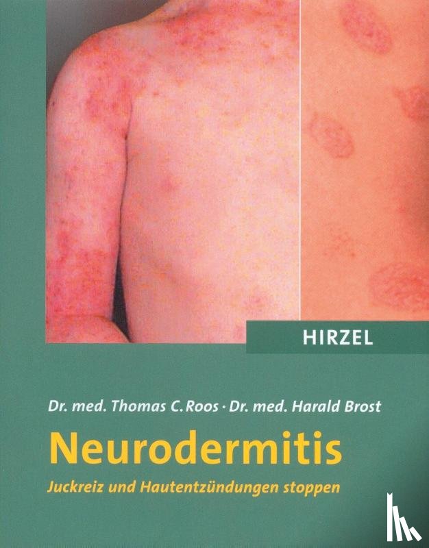 Roos, Thomas C., Brost, Harald - Neurodermitis