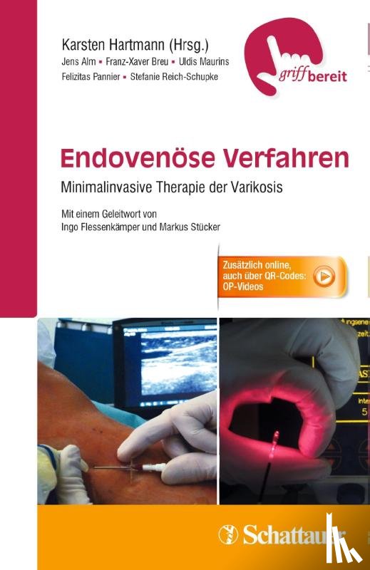 Alm, Jens, Breu, Franz-Xaver, Maurins, Uldis, Pannier, Felizitas - Endovenöse Verfahren