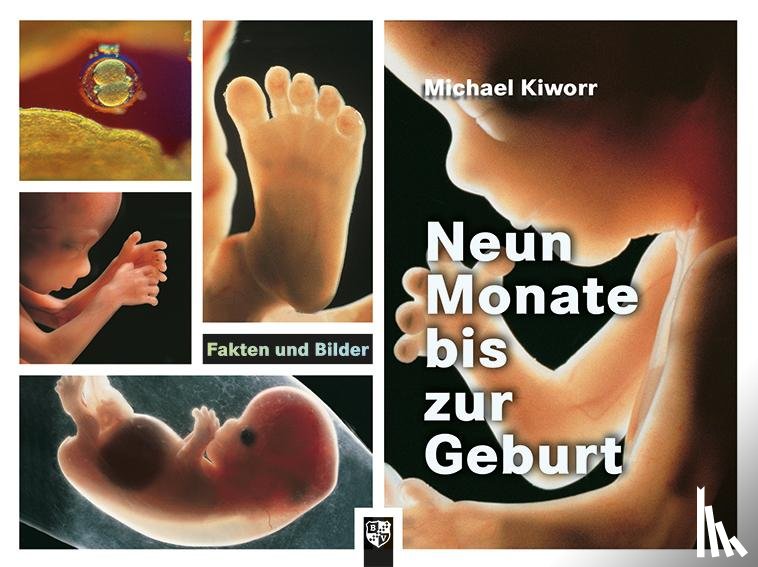 Kiworr, Michael - Neun Monate bis zur Geburt