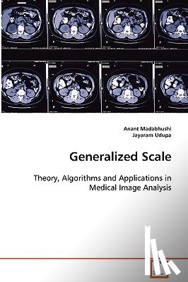 Madabhushi, Anant, Udupa, Jayaram - Generalized Scale