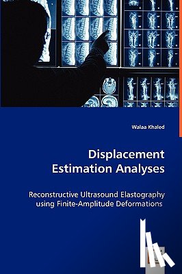 Khaled, Walaa - Displacement Estimation Analyses