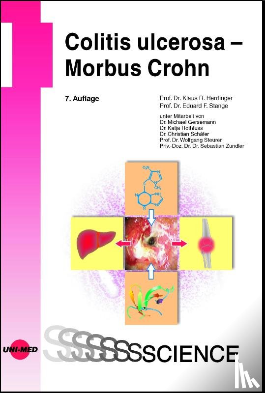 Herrlinger, Klaus R., Stange, Eduard F. - Colitis ulcerosa - Morbus Crohn