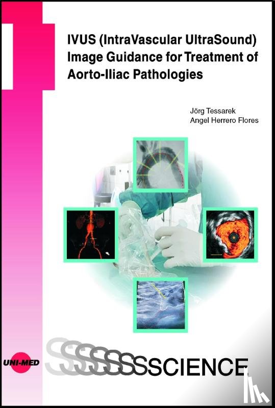 Tessarek, Jörg, Herrero Flores, Angel - IVUS (IntraVascular UltraSound) Image Guidance for Treatment of Aorto-Iliac Pathologies