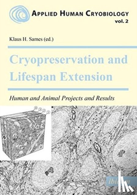  - Cryopreservation and Lifespan Extension