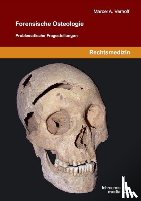Verhoff, Marcel A. - Forensische Osteologie