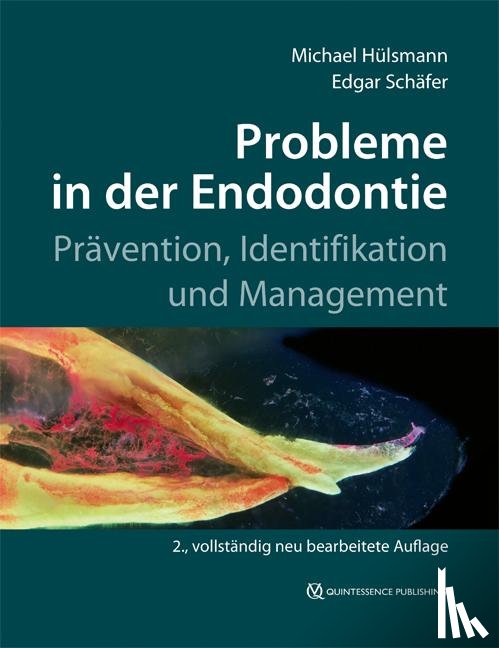 Hülsmann, Michael, Schäfer, Edgar - Probleme in der Endodontie