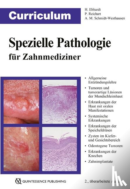 Ebhardt, Harald, Reichart, Peter A., Schmidt-Westhausen, Andrea Maria - Curriculum Spezielle Pathologie für Zahnmediziner