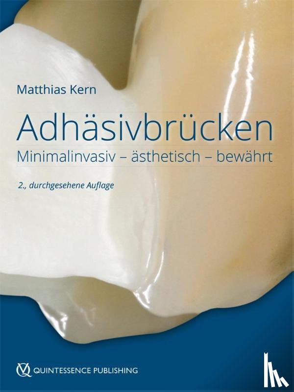 Kern, Matthias - Adhäsivbrücken