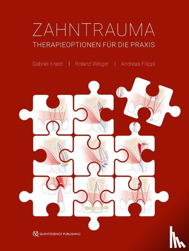 Krastl, Gabriel, Weiger, Roland, Filippi, Andreas - Zahntrauma