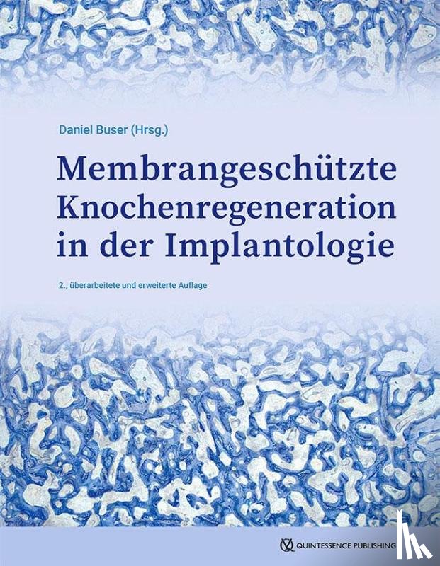  - GBR-Technik in der Implantologie