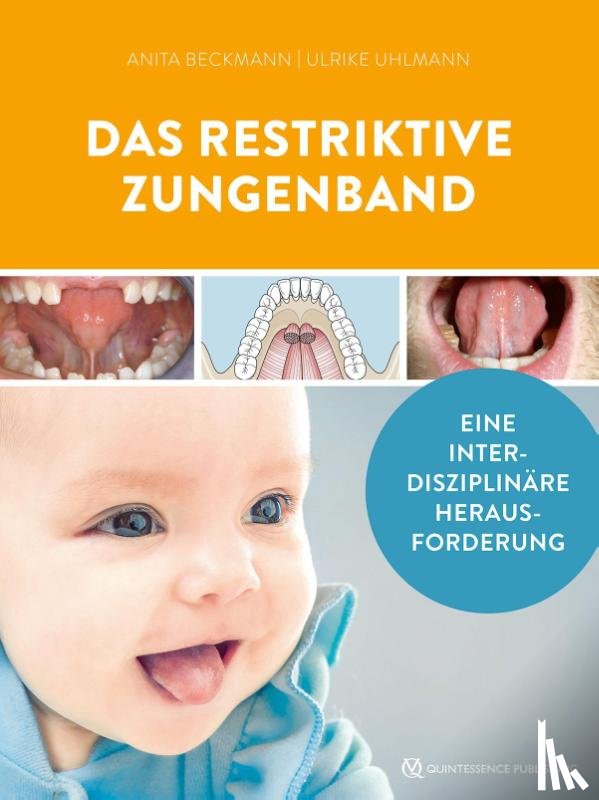  - Das restriktive Zungenband